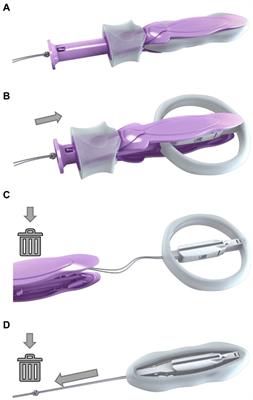 A randomized controlled study comparing the objective efficacy and safety of a novel self-inserted disposable vaginal prolapse device and existing ring pessaries